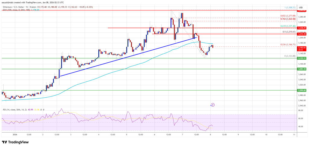 Ethereum Price Latest Push Raises Question: Has a Short-Term Top Formed? Ethereum Price Latest Push Raises Question: Has a Short-Term Top Formed?